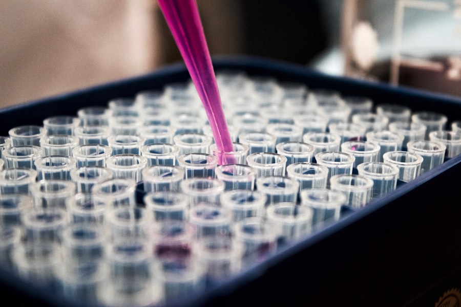 Tests & Diagnosis